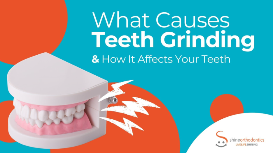 Graphic with a teal and orange circle background featuring the title "What Causes Teeth Grinding & How It Affects Your Teeth." On the left sits a plastic anatomical model of teeth and pink gums, with 